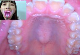 【HD】街角で声をかけて口内観察させてもらう　アパレル関係　ひなみちゃん