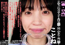 【HD】【歯・口内】大人気美女ことねチャンのマウスオープナーを付けて歯観察・口内・のどちんこ・舌ベロ観察!ことね