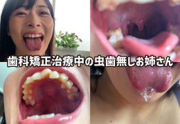 【HD】街角で声をかけて口内観察させてもらう　ファーストフード店パート　みおりさん